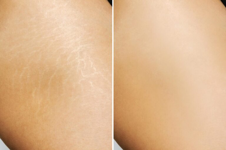 Service skin corrections