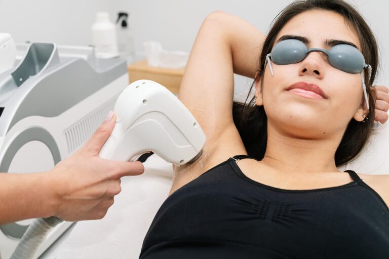 Diode laser hair removal on a woman's underarm